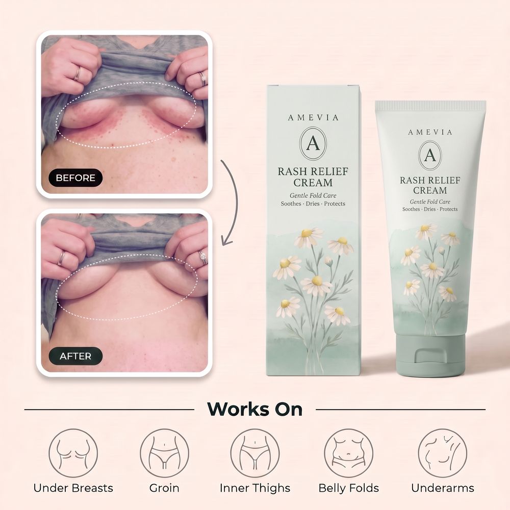 Amevia Rash Relief Cream tube and carton with a before and after of an under-bust rash, and the five areas it works on