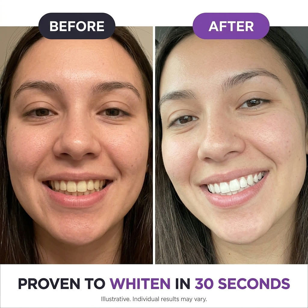 Before and after whitening with PurpleSnow Gels