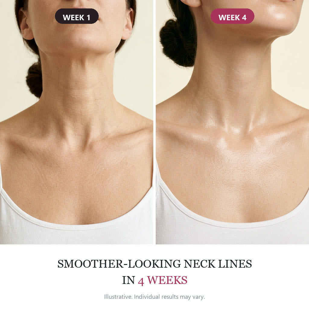 SeoulLift pdp-05-before-after-neck